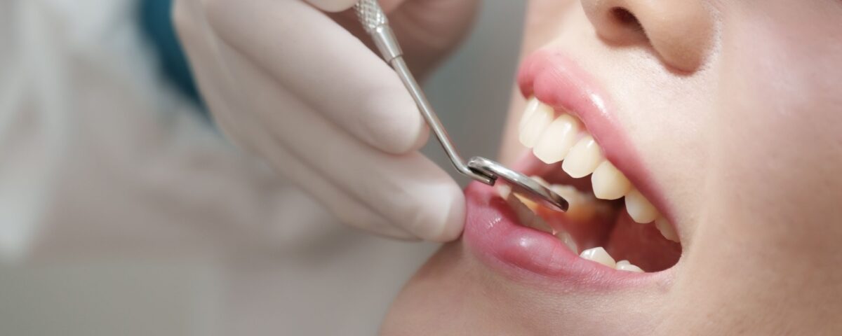 A close up of a persons mouth as a dentist uses a specialized mirror to see behind their front teeth