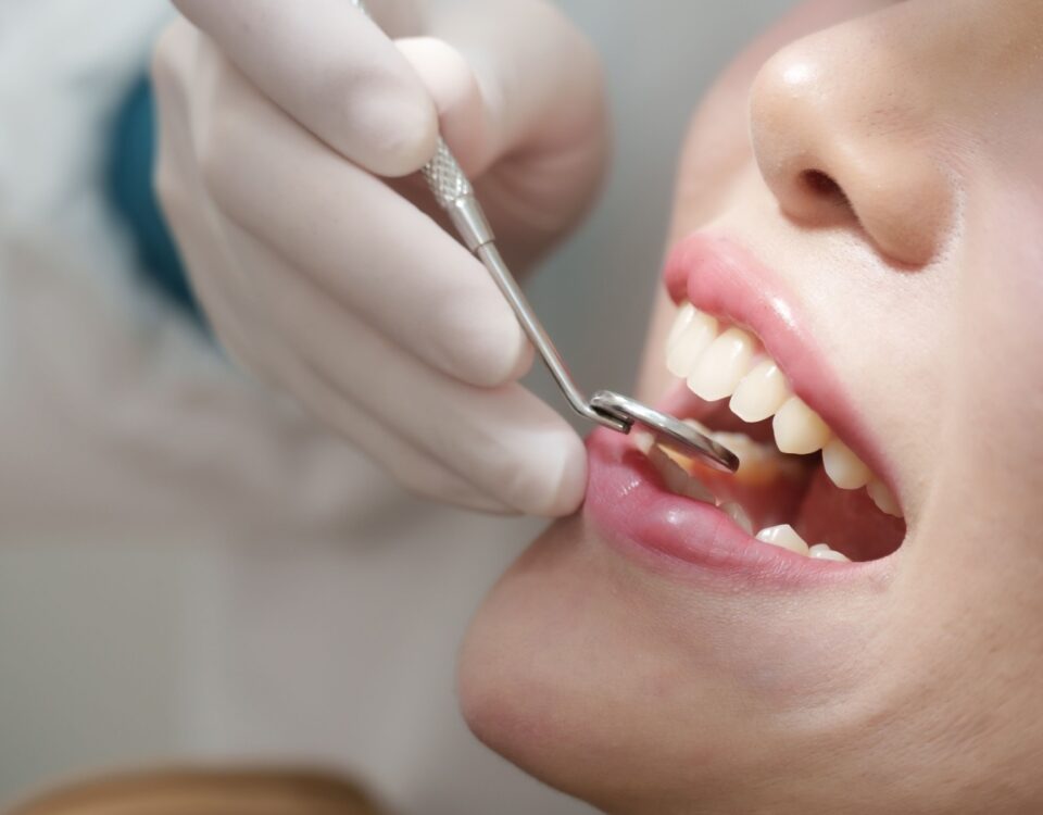 A close up of a persons mouth as a dentist uses a specialized mirror to see behind their front teeth