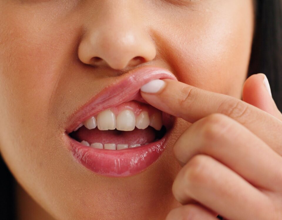A close up of a persons gum line